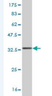 Western Blot: CEP250 Antibody (4A1) [H00011190-M02]