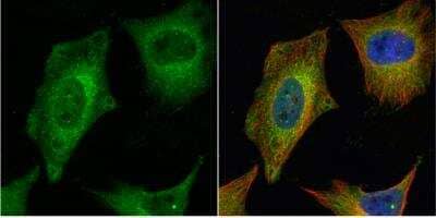 Immunocytochemistry/ Immunofluorescence: CEP27 Antibody [NBP2-15861]