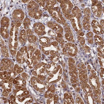 Immunohistochemistry-Paraffin: CEP27 Antibody [NBP1-89895]