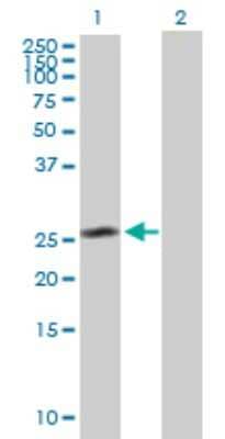 Western Blot: CEP27 Antibody [H00055142-B01P]