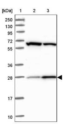 Western Blot: CEP27 Antibody [NBP1-89895]