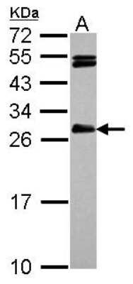 Western Blot: CEP27 Antibody [NBP2-15860]