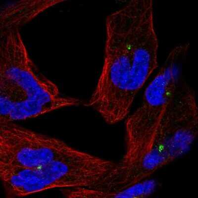 Immunocytochemistry/ Immunofluorescence: CEP290 Antibody [NBP2-57104]