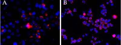 Immunocytochemistry/ Immunofluorescence: CEP290 Antibody [NBP1-52132]