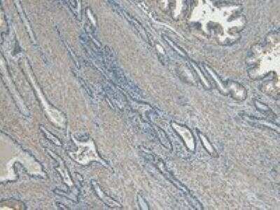 Immunohistochemistry-Paraffin: CEP290 Antibody [NBP1-52132]