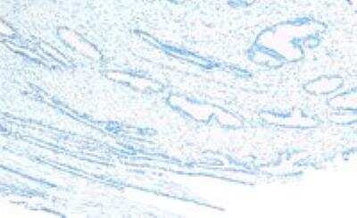 Immunohistochemistry-Paraffin: CEP290 Antibody [NBP1-52132]