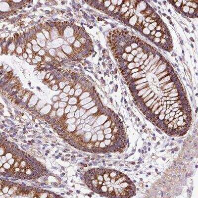 Immunohistochemistry-Paraffin: CEP290 Antibody [NBP2-33406]