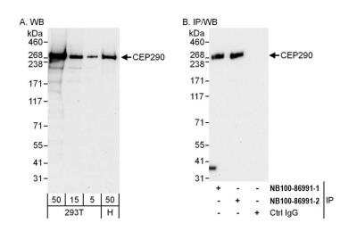 Western Blot: CEP290 Antibody [NB100-86991]