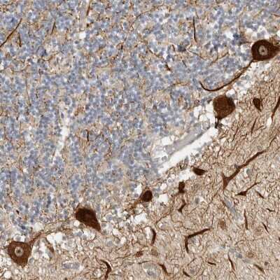 Immunohistochemistry: CEP295NL Antibody [NBP2-47512]