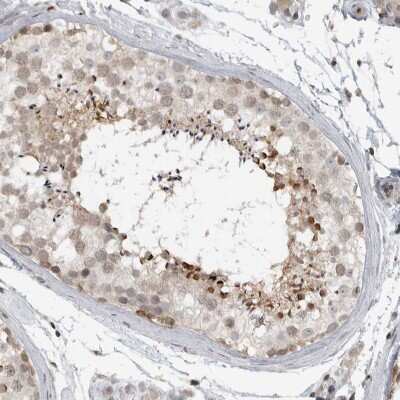 Immunohistochemistry-Paraffin: CEP295NL Antibody [NBP2-48574]