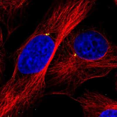 Immunocytochemistry/ Immunofluorescence: CEP350 Antibody (CL3423) [NBP2-59028]