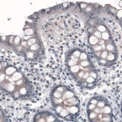 Immunohistochemistry-Paraffin: CEP350 Antibody (CL3423) [NBP2-59028]