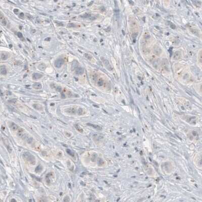 Immunohistochemistry-Paraffin: CEP350 Antibody (CL3423) [NBP2-59028]