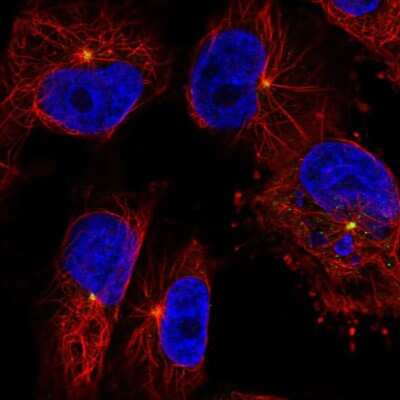 Immunocytochemistry/ Immunofluorescence: CEP350 Antibody [NBP2-55557]