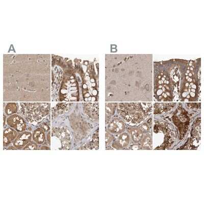 Immunohistochemistry-Paraffin: CEP350 Antibody [NBP1-86637]