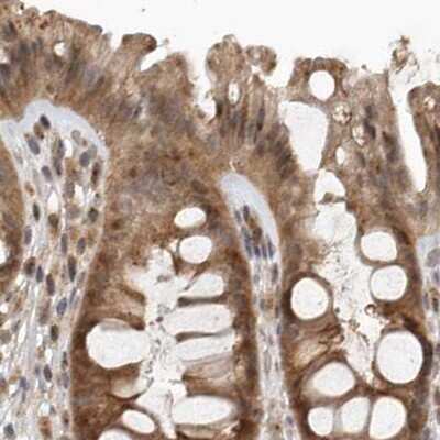 Immunohistochemistry-Paraffin: CEP350 Antibody [NBP1-86637]