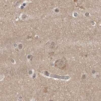 Immunohistochemistry-Paraffin: CEP350 Antibody [NBP1-86637]