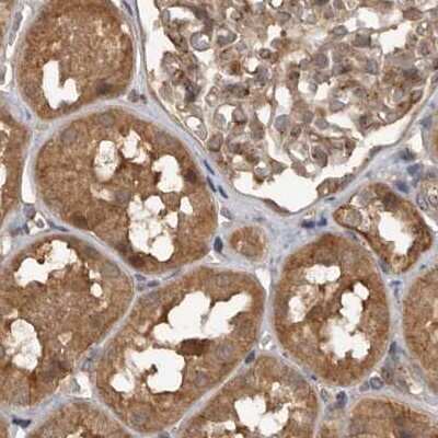 Immunohistochemistry-Paraffin: CEP350 Antibody [NBP1-86637]