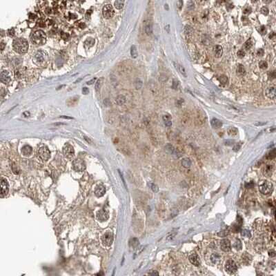 Immunohistochemistry-Paraffin: CEP350 Antibody [NBP1-86637]