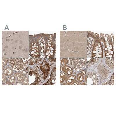 Immunohistochemistry-Paraffin: CEP350 Antibody [NBP1-86638]