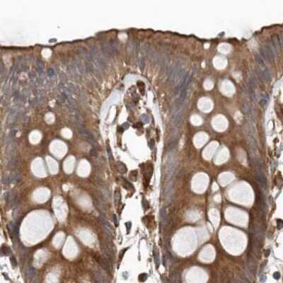 Immunohistochemistry-Paraffin: CEP350 Antibody [NBP1-86638]