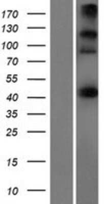 Western Blot: CEP44 Overexpression Lysate [NBP2-09737]