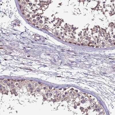 Immunohistochemistry-Paraffin: CEP55 Antibody [NBP1-91778]