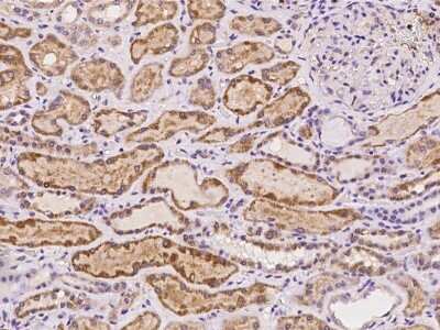 Immunohistochemistry-Paraffin: CEP55 Antibody [NBP2-97195]