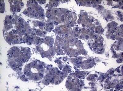 Immunohistochemistry: CEP55 Antibody (OTI10C4) - Azide and BSA Free [NBP2-71990]