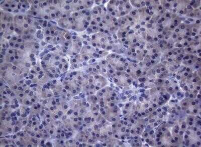 Immunohistochemistry: CEP55 Antibody (OTI10C4) - Azide and BSA Free [NBP2-71990]