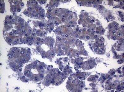 Immunohistochemistry-Paraffin: CEP55 Antibody (OTI10C4) [NBP2-46241]