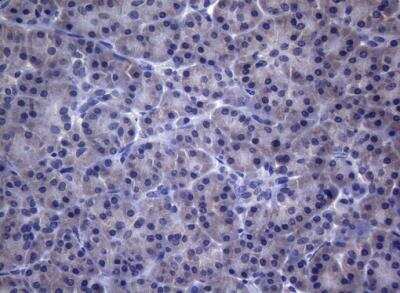 Immunohistochemistry-Paraffin: CEP55 Antibody (OTI10C4) [NBP2-46241]