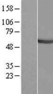 Western Blot: CEP55 Overexpression Lysate [NBL1-09098]