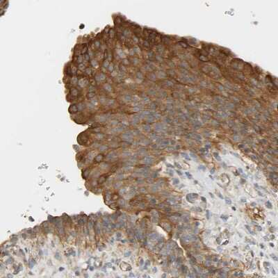 Immunohistochemistry-Paraffin: CEP57 Antibody [NBP1-83045]