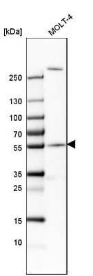 Western Blot: CEP57 Antibody [NBP1-83045]