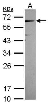 Western Blot: CEP57 Antibody [NBP2-15863]