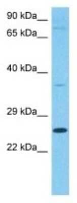 Western Blot: CEP57 Antibody [NBP3-10691]