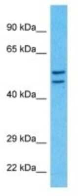 Western Blot: CEP57 Antibody [NBP3-10779]