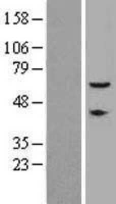 Western Blot: CEP57 Overexpression Lysate [NBL1-09099]