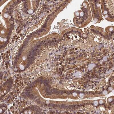 Immunohistochemistry-Paraffin: CEP57L1 Antibody [NBP1-88761]