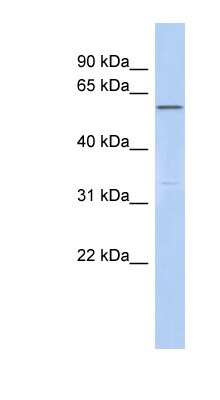 Western Blot: CEP57L1 Antibody [NBP1-70497]