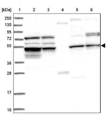 Western Blot: CEP57L1 Antibody [NBP1-88761]