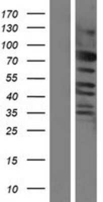 Western Blot: CEP57L1 Overexpression Lysate [NBP2-05107]