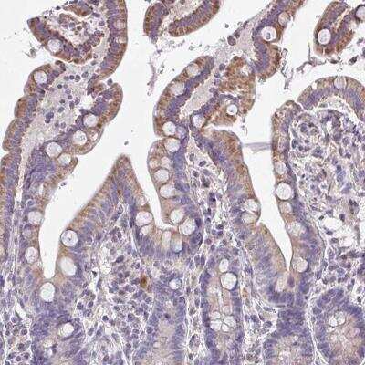 Immunohistochemistry-Paraffin: CEP63 Antibody [NBP2-31706]