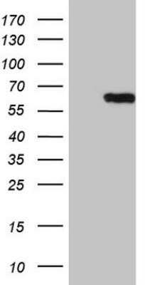 Western Blot: CEP63 Antibody (OTI2H2)Azide and BSA Free [NBP2-72221]