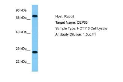 Western Blot: CEP63 Antibody [NBP2-84657]