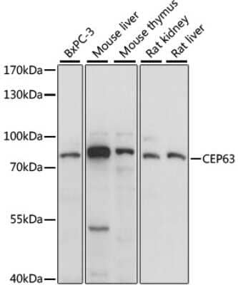 Western Blot: CEP63 AntibodyAzide and BSA Free [NBP2-92243]