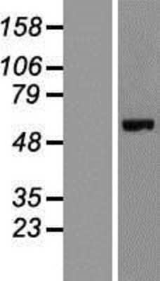 Western Blot: CEP63 Overexpression Lysate [NBL1-09102]