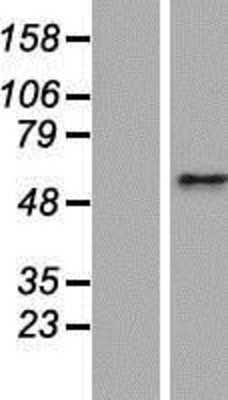 Western Blot: CEP63 Overexpression Lysate [NBP2-09226]