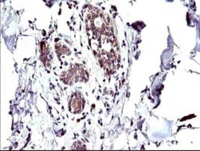 Immunohistochemistry: CEP68 Antibody (OTI5B4) [NBP2-46252]